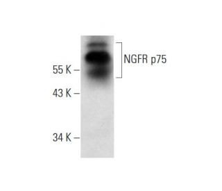 western blotting image from recommended NGFR p75 (B-1) monoclonal antibody replacement. Image 135978