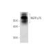 western blotting image from recommended NGFR p75 (B-1) monoclonal antibody replacement. Image 135978