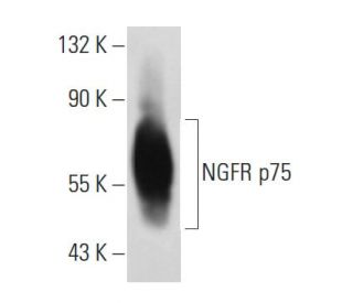 NGFR p75 Antibody (MC-192) - Western Blotting - Image 14717