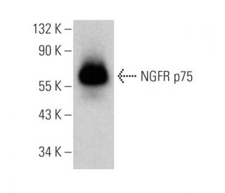 NGFR p75 Antibody (NGFR5) - Western Blotting - Image 377297 