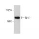 western blotting image from recommended NHE-1 (B-12) monoclonal antibody replacement. Image 384672