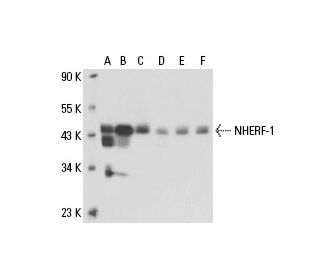 NHERF-1 Antibody (4i337) - Western Blotting - Image 17894 