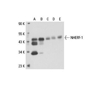 NHERF-1 Antibody (6D364) - Western Blotting - Image 17895 