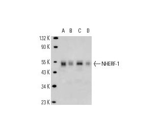 NHERF-1 Antibody (EBP-10) - Western Blotting - Image 12817 