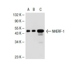 NHERF-1 Antibody (4i337) - Western Blotting - Image 38202