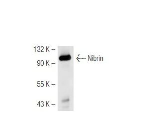 Nibrin Antibody (1D7) - Western Blotting - Image 49252 