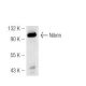 Nibrin Antibody (1D7) - Western Blotting - Image 49252 