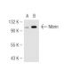 Nibrin Antibody (1D7) - Western Blotting - Image 49257