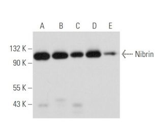 western blotting image from recommended Nibrin (B-5) monoclonal antibody replacement. Image 333816