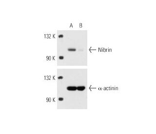 Nibrin siRNA (h): sc-36061. Western blot analysis of Nibrin expression in non-transfected control (A) and Nibrin siRNA tra 