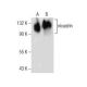 nicastrin Antibody (D-1) - Western Blotting - Image 155415 