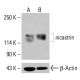 Anticuerpo nicastrina (F-3): sc-377214. Análisis por Western blot de la expresión de nicastrina en lisados celulares completos HeLa no tratados (A) y tratados químicamente (B). β-Actina (C4): sc-47778 utilizado como control de carga. Reactivo de detección utilizado: m-IgG Fc BP-HRP: sc-525409. nicastrin Antibody (F-3) - Western Blotting - Image 414910