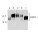 This polyclonal antibody has been discontinued. See our recommended <a href="nicastrin-antibody-b-3">nicastrin (B-3)</a> monoclonal antibody (sample data shown). western blotting image from recommended nicastrin (B-3) monoclonal antibody replacement. Image 356999