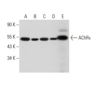Nicotinic Acetylcholine Receptor epsilon/CHRNE Antibody (B-11) - Western Blotting - Image 301133