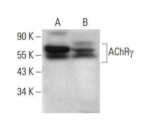Nicotinic Acetylcholine Receptor gamma/CHRNG Antibody (145) - Western Blotting - Image 382867Each CRISPR/Cas9 Knockout (KO) Plasmid product consists of a pool of 3 plasmids designed to ensure identification and cleavage of a specific gene for maximum knockout efficiency. Each plasmid encodes a unique 20 nt sequence derived from the GeCKO (v2) library.