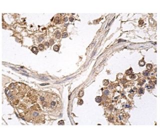 immunohistochemistry image from recommended NIK (A-12) monoclonal antibody replacement. Image 156686