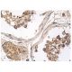 This polyclonal antibody has been discontinued. See our recommended <a href="nik-antibody-a-12">NIK (A-12)</a> monoclonal antibody (sample data shown). immunohistochemistry image from recommended NIK (A-12) monoclonal antibody replacement. Image 156686