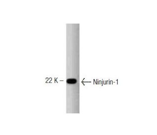 Ninjurin-1 Antibody (50) | SCBT - Santa Cruz Biotechnology