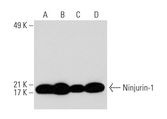 その他 A ninjurin-1-antibody-50-western