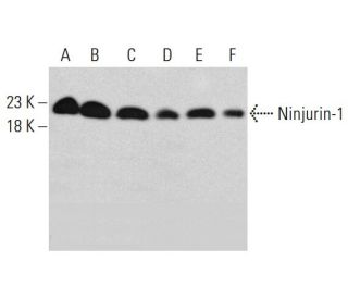 ninjurin-1-antibody-50-western
