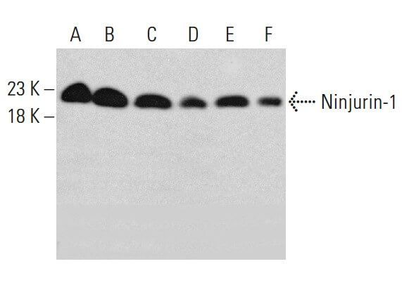 Ninjurin-1抗体(50) | SCBT - Santa Cruz Biotechnology