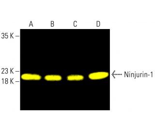Ninjurin-1 Antibody (50) | SCBT - Santa Cruz Biotechnology