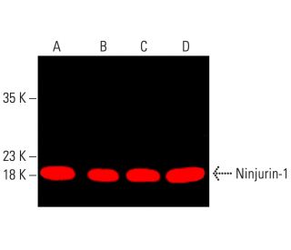 Ninjurin-1 Antibody (50) | SCBT - Santa Cruz Biotechnology