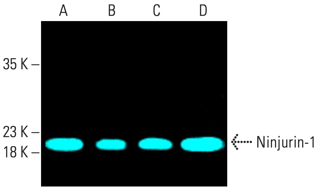 その他 A 0000765196_01.jpg?h=600&w=600