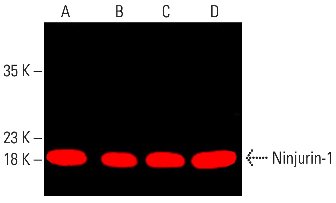 その他 A ninjurin-1-antibody-50-western