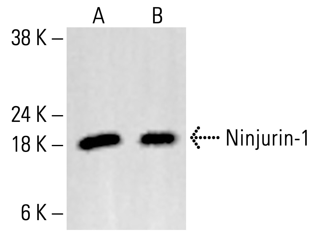 Ninjurin-1 Antibody (50) | SCBT - Santa Cruz Biotechnology