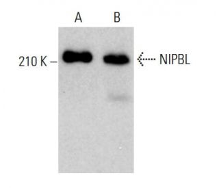 NIPBL Antibody (C-9) - Western Blotting - Image 376076The Double Nickase Plasmid features a U6 promoter for sgRNA expression, a 20 nt targeting sequence, and a gRNA scaffold to guide Cas9n. It includes a CBh promoter for Cas9n (D10A) and puromycin resistance, GFP for transfection verification, and nuclear localization signals (NLS). The 2A peptide allows co-expression of Cas9n and Puro from a single promoter, enabling precise genome editing with reduced off-target effects. 