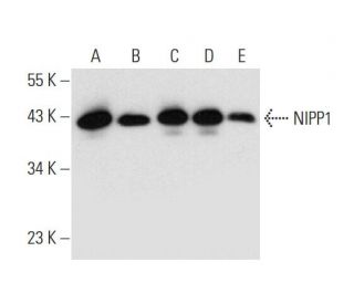NIPP1 Antibody (A-11) - Western Blotting - Image 300102