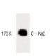 Nir2 Antibody (8) - Western Blotting - Image 60216 
