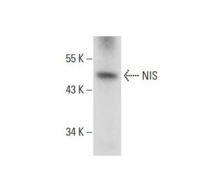 NIS Antibody (G-5) - Western Blotting - Image 319389 