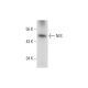 NIS Antibody (G-5) - Western Blotting - Image 319389 