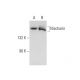 Nischarin Antibody (B-3) - Western Blotting - Image 139177 