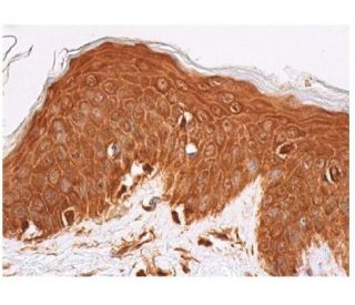 nitrated alpha/beta Synuclein Antibody (4H317) - Immunohistochemistry - Image 350547 