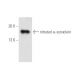 nitrated alpha Synuclein Antibody (Syn514) - Western Blotting - Image 14561