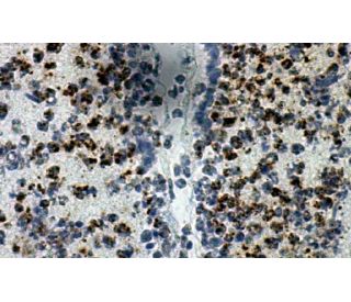 Nitrotyrosine Antibody (39B6) - Immunohistochemistry - Image 9243 