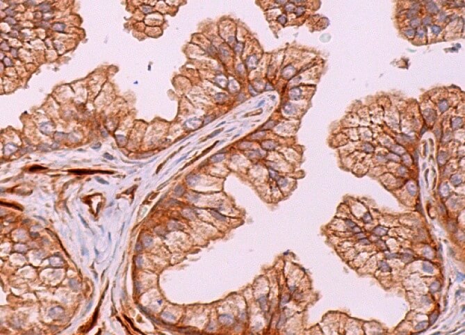 ＊111CRDPリキッドP35%1mlOGKUSH H4CBD CBN CBG PRMT5 K240lac confers ferroptosis resistance via ALKBH5