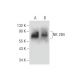 NK 2B4 Antibody (HD2) - Western Blotting - Image 57510 