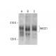 NKCC1 Antibody (A-6) - Western Blotting - Image 351855 