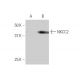 NKCC2 Antibody (4H4) - Western Blotting - Image 347578 
