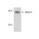 NKG2-D Antibody (5C6) - Western Blotting - Image 285095 
