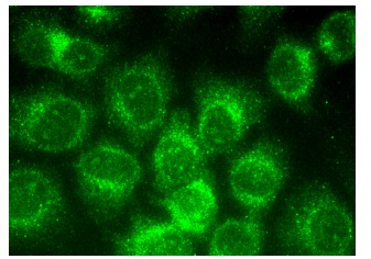 NKHC1 Antibody (C-11) | SCBT - Santa Cruz Biotechnology