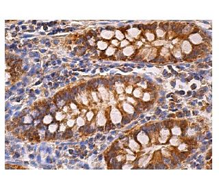 NKHC1 Antibody (C-11) - Immunohistochemistry - Image 157931 