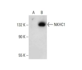 NKHC1 Antibody (D-3) - Western Blotting - Image 308398 