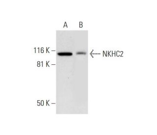 NKHC2 Antibody (A-2) - Western Blotting - Image 291061