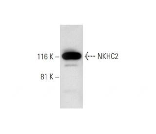 NKHC2 Antibody (B-9): sc-374469