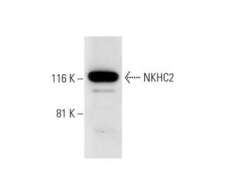 NKHC2 Antibody (E-5): sc-374468